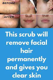 This Scrub Will Remove Facial Hair Permanently And Gives You Clear Skin The Excess Growt Stop Facial Hair Growth Facial Hair Growth Natural Facial Hair Removal