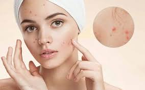 Lợi ích của trà húng chanh đối với sức khỏe