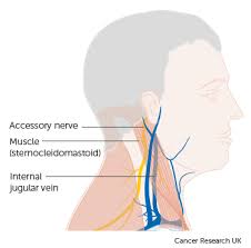 Lymph nodes in the neck are oval or ellipsoid in shape. Surgery To Remove The Lymph Nodes In Your Neck Laryngeal Cancer Cancer Research Uk