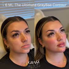 1. “She wanted snatched but natural 👀✨” 2. “6 MLs placed strategical...