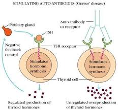 Hyperthyroidism Graves Disease Please Continue Read Thyroid Disease Symptoms Graves Disease Thyroid Nodule Treatment
