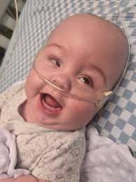 Pittsburgh residents and their experiences with stairs