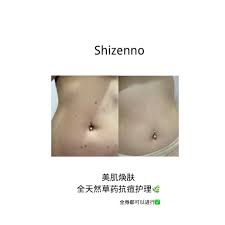 Shuruba ethiopian hair butter is made from milk as well as assorted oils that helps hair maintain its natural strength and shine. Follow Up Beauty Photos Facebook