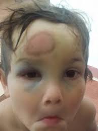 Shopper leaves a little boy bruised and battered