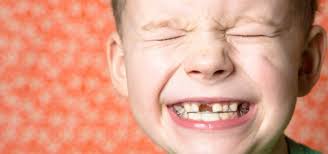 Traumatismo Dental Que Hacer Tras Recibir Un Fuerte Golpe En Un Diente