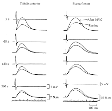 Https Www Researchgate Net Profile Gernot Hering Publication 30019897 Uber Mechanische Und Elektrophysiologische Eigenschaften Von So Genannt Langsamen Und Schnellen Muskeln Eine Untersuchung Am Mquadriceps Femoris Von Marathonlaufern Sprintern Volleyballspielern Und Links 58b9e1f345851591c5dc7463 Ueber Mechanische Und Elektrophysiologische Eigenschaften Von So Genannt Langsamen Und Schnellen Muskeln Eine Untersuchung Am Mquadriceps Femoris Von Marathonlaeufern Sprintern Volleyballspielern Pdf