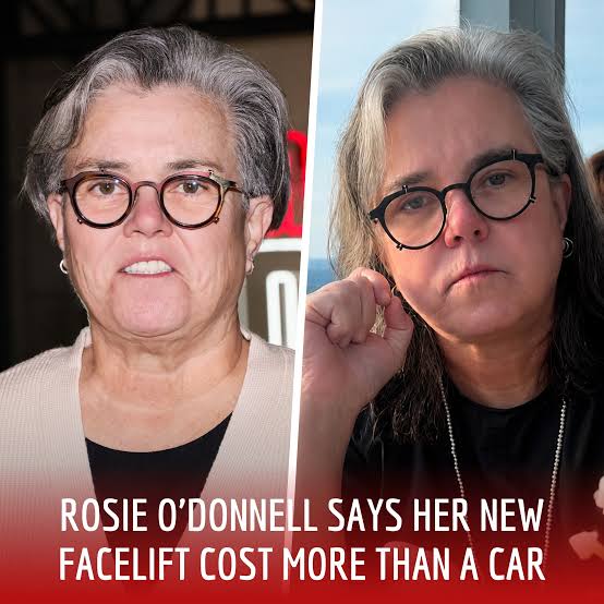 Rosie O'Donnell has everyone talking after stepping onto the red carpet  with a noticeably different look. Following a significant weight loss and a  recent facelift, the change is hard to miss. Many