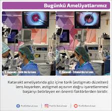 Katarakt Ameliyatinda Goz Icine Torik Astigmati Duzelten Lens Koyarken Astigmat Acisinin Dogru Isaretlenmesi Basariyi Belirleyen En Onemli F Bilgi Ikiz Ordu