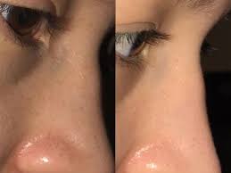 If you're obsessive about your mane,, you've probably heard about monat haircare. This Is How One Reddit User Eliminated Blackheads For Good