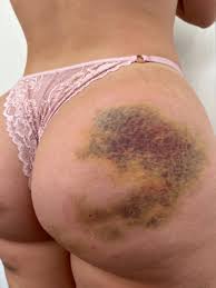 Kerolay Chaves faz ensaio para capa da Playboy da Dinamarca - Primeira  Hora🥝 Viva a emoção do jogo com baixa Galera Bet