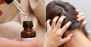 Itchy Scalp Is An Uncomfortable Condition Where You Will Be Always Scratching Your Head An Itchy Coconut Oil Hair Growth Coconut Oil For Acne Coconut Oil Hair