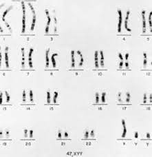 Males With Polysomy Y And Females With Polysomy X Glowm