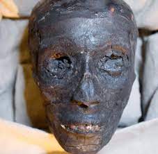 Es gab einmal so einen kleinen könig, vor mehr als 3000 jahren in ägypten: Inzest Pharao Tutanchamun Starb Wohl An Erblicher Blutkrankheit Welt