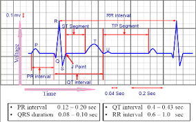 Ecgbasicdysrythmmias