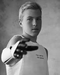 limb difference Archives