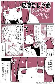 ささくれを剥く癖がやめられない話 : 愛内あいるの絵日記