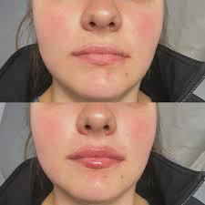 Brightside Aesthetics