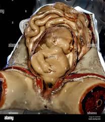 Image result for Shoulder Presentation