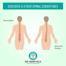Ibshospitals Have The Best Surgeons Who Have Expertise In Expanding The Field Of Minimally Invasive Spine Surg Spine Surgery Care Hospital How To Stay Healthy
