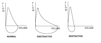 Flow Volume Loops