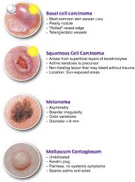 Improved Pance Panre Qbank New Content Images Roshreview Com Oral Pathology Wound Care Nursing Medical Knowledge