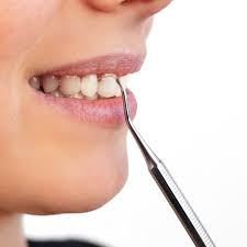 Wie man zahnbelag entfernt ohne zum zahnarzt gehen zu müssen! Zahnsteinentferner Entfernen Von Zahnstein Remos Shop At