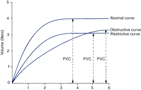 Image result for Pulmonary Function Test Lower Limit of Normal