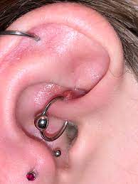 I Can T Get Rid Of This Daith Bump I Ve Had This Piercing Since October What Is It Piercing