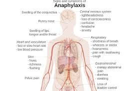 Anaphylaxis is a medical emergency that requires immediate recognition and. Anaphylaxis And Treatment Of An Anaphylactic Reaction