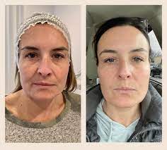 I most definitely will continue as a customer for future purchase/treatments. Nova Aesthetic Center Home Facebook