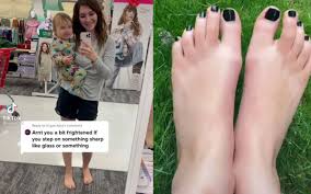 Tiktoker non indossa più le scarpe e dichiara:sono la prigione per i piedi !