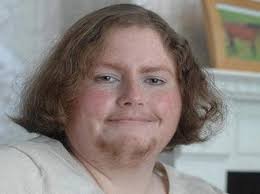 Cresterea penisului incepe la pubertate. Nu Si Rade Barba De O Luna Cum Arata O Englezoaica Diagnosticata Cu Sindromul Ovarelor Polichiste