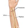 These bones are specially designed in. 1