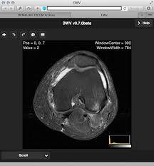 Maybe you would like to learn more about one of these? 5 Dicom Viewers For Any Practice