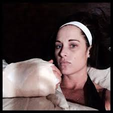 Years of wrist pain...finally had surgery