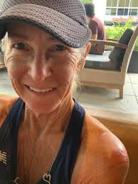 Beverly Farms Library Talk Cancellation due to Injury