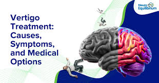 Image result for Vertigo