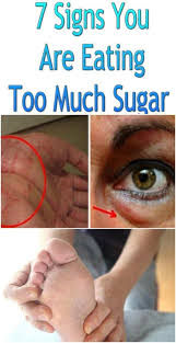 7 Signs You Are Eating Too Much Sugar Medi Idea Ate Too Much Health Healthy Tips