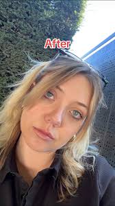 Stopped Drinking Poofy Face Before