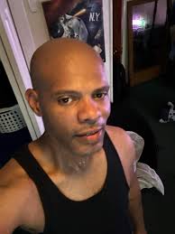 Flashes and clouds in vision, how long do they last?