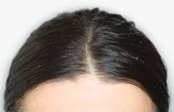 Image result