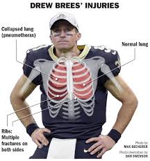 When any of these organs are infected, inflamed, or injured, pain can radiate under and around the. Drew Brees Reportedly Has Fractured Ribs And A Collapsed Lung Optimistic Timetable Is 2 3 Weeks Saints Nola Com