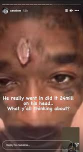 Is that a $24 million diamond embedded in your forehead? Lil Uzi Vert Apparently Got A Nearly 11 Carat Diamond Pierced Into His Forehead Huffpost Uk