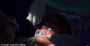 Veneers consist of a very thin layer of porcelain that's bonded to the front of teeth, and leaves more of them intact, as only a little bit of the tooth is shaved off. Katie Price Shows Off Her Metal Teeth As She Gets Veneers Fitted Daily Mail Online