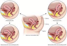 E Se Meu Utero For Ao Contrario A Velha Historia Do Utero Invertido By Dani Imperador Evadescomplica Medium