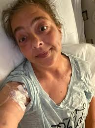 Lymphedema Facts of My Life