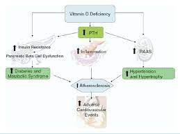 Het Vitamine D Deficientie Syndroom Ppt Download