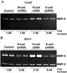 The cytoplasmic domain of N-cadherin modulates MMP‑9 induction in oral  squamous carcinoma cells