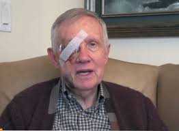 Image result for harry reid beat up