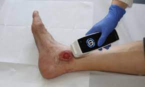 Seltene fledermaustollwut in minden nachgewiesen beachten sie dabei bitte unsere regeln für leserkommentare. Vibrionen Gefahr Im Badesee Healthcare In Europe Com